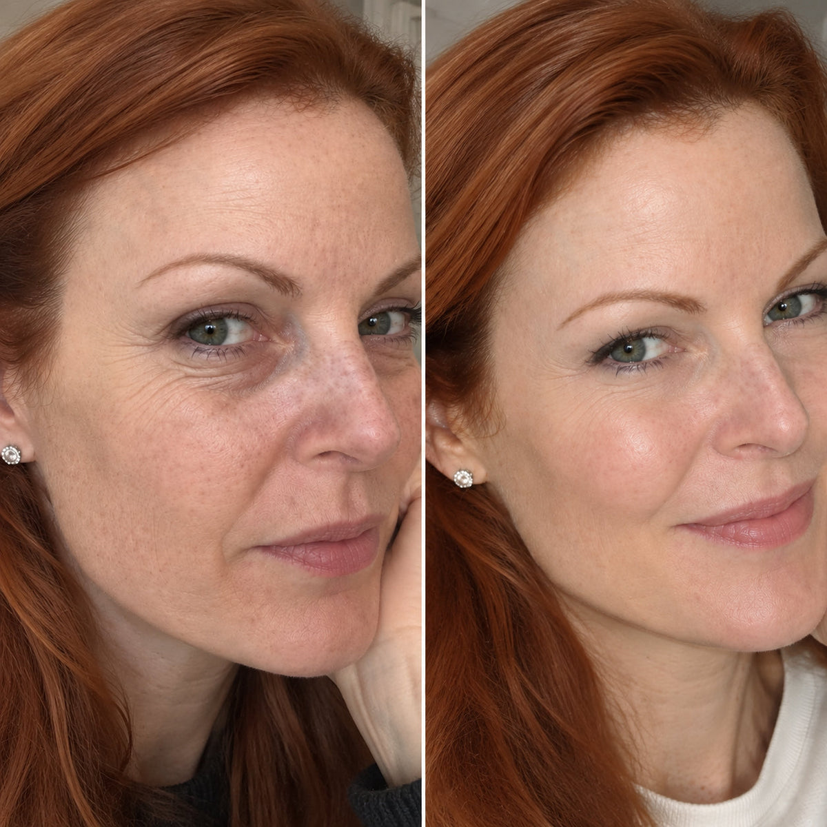 ⏳ Last day to save 63%✨ Eye Renewal Cream