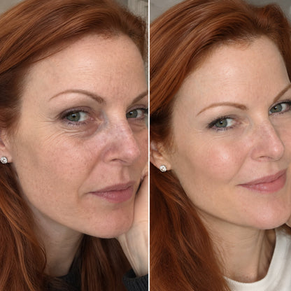⏳ Last day to save 63%✨ Eye Renewal Cream